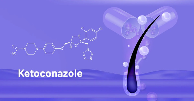 Keteconazol được ưu tiên sử dụng trong các sản phẩm dầu gội trị gàu. Keteconazol được ưu tiên sử dụng trong các sản phẩm dầu gội trị gàu.
